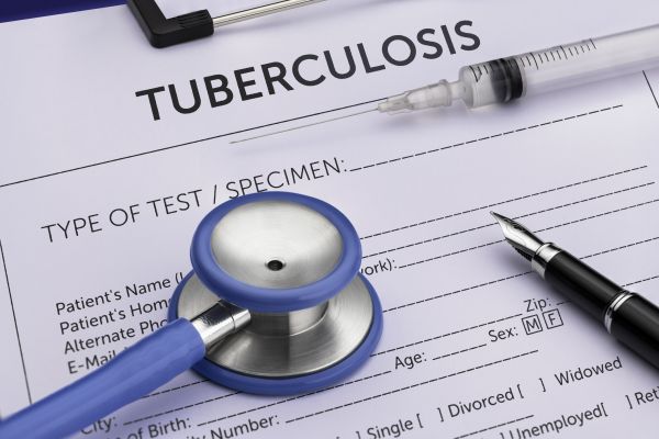 Tuberculosis Testing and Treatment